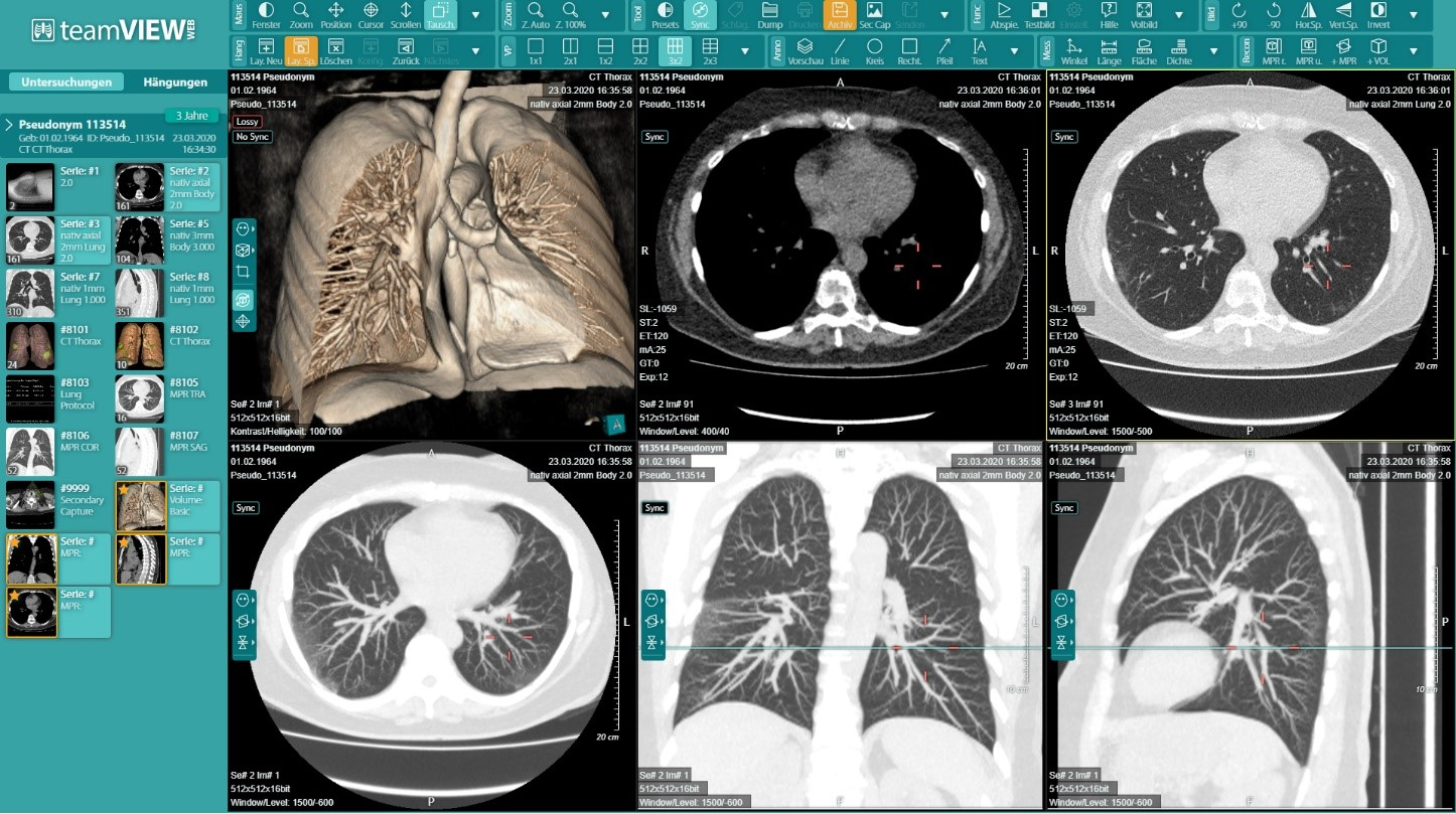 How Digithurst and Telepaxx built a secure and scalable radiology solution chain using AWS