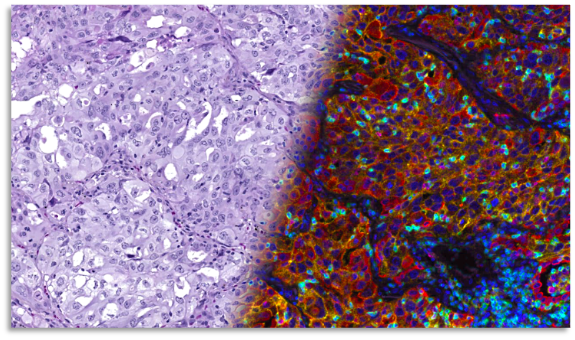 Large scale AI in digital pathology without the heavy lifting  AWS Public Sector Blog.md