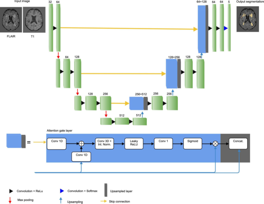 Icometrix helps to detect and treat neurological diseases with AI imaging, powered by AWS.md