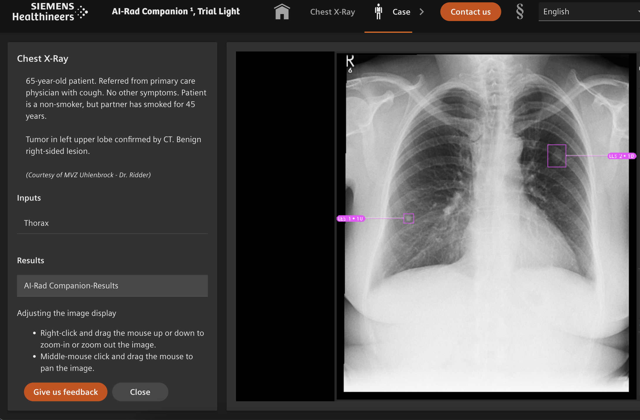 AI-Rad Companion from Siemens Healthineers Press Release of the Product Launch